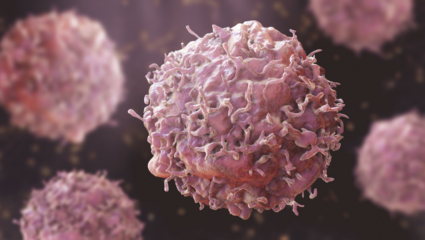 शरीरात कशी होते Cancer ची सुरुवात? कोणकोणते आहेत टप्पे? वेळीच जाणून घ्या आणि स्वतःचे रक्षण करा