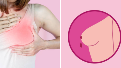 ना प्रेग्नंन्सी, ना स्तनपान, तरीही होतंय Nipple Discharge, गंभीर आजाराचे लक्षण; दुर्लक्ष करणे बेतेल जीवावर