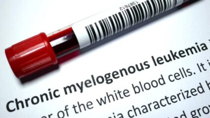 CML आजार म्हणजे नक्की काय? भारतीय रुग्णांना ‘या’ गोष्टी माहीत असायलाच हव्यात