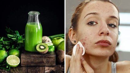 पिंपल्समुळे खराब झालेली त्वचा स्वच्छ करण्यासाठी नियमित करा ‘या’ हिरव्या ज्यूसचे सेवन, पिगमेंटेशन-फोड होतील नष्ट