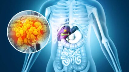 दारू पिऊन सडलेले Liver पुन्हा स्वच्छ करण्यासाठी आहारात करा ‘या’ पदार्थांचा समावेश, लिव्हरवरील भार होईल कमी