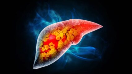 लिव्हर खराब झाल्यानंतर पायांमध्ये दिसून येतात ‘ही’ गंभीर लक्षणे, हलक्यात घेण्याची चूक शरीरासाठी ठरेल धोक्याची