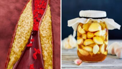 नसांमध्ये साचून राहिलेले खराब कोलेस्ट्रॉल कमी करण्यासाठी ‘या’ नॅचरल फूड्सचे करा सेवन,हृदयविकाराचा धोका होईल कमी