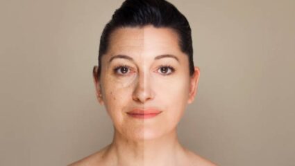 चेहऱ्यावर आलेल्या सुरकुत्या कायमच्या होतील नष्ट! त्वचा कायमच तरुण ठेवण्यासाठी फॉलो करा ‘या’ सोप्या टिप्स