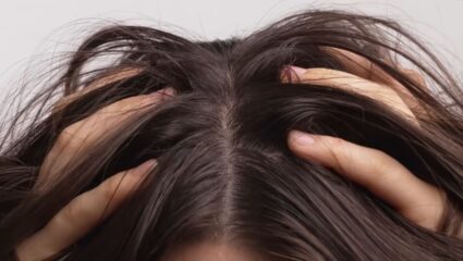 टाळूवरील त्वचा वारंवार कोरडी पडते? मग स्वयंपाक घरातील ‘या’ पदार्थांचा करा वापर, स्काल्प होतील स्वच्छ