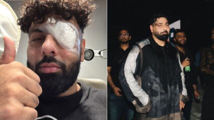बादशाह झाला जखमी, डोळ्यावर दिसली बांधलेली पट्टी; फोटो पाहून चाहते चकीत