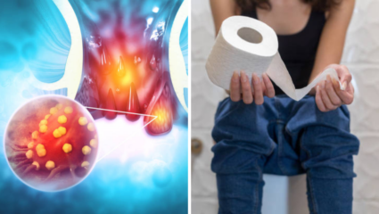 Constipation Remedies: बद्धकोष्ठतेने हैराण असल्यास केवळ फायबर पुरेसे नाही, लॅक्झेटिव्ह्जचा करा वापर; तज्ज्ञांचा सल्ला