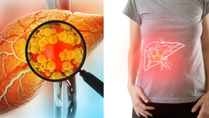 14 दिवसात फॅटी लिव्हर बरं होण्याचा दावा, सकाळी उपाशीपोटी प्या ‘हे’ ड्रिंक; बनविण्याची सोपी पद्धत