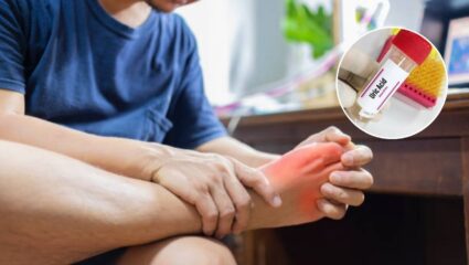 घरातल्या या 5 पदार्थांच्या सेवनाने सांध्यात अडकलेलं संपूर्ण युरिक अ‍ॅसिड लघवीतून पडेल बाहेर; आजच खा नाहीतर होईल मुतखड्याचा त्रास