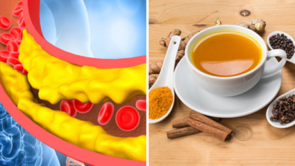 नसांमध्ये चिकटलेले Cholesterol गाळून बाहेर काढते हळद, Immunity देखील करते बूस्ट, डाएटमध्ये कसा करावा वापर
