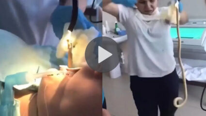 अहो आश्चर्यम्! महिला झोपली अन् तोंडातून बाहेर आले नागराज; Viral Video पाहून व्हाल भयभीत