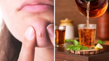 महिनाभरात गायब होतील चेहऱ्यावरील पिंपल्स आणि फोड! रात्री झोपण्याआधी नियमित प्या ‘हे’ खास आयुर्वेदिक पेय