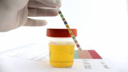 कॅन्सर- किडनी इन्फेक्शन झाल्यानंतर लघवीमध्ये दिसून येतात ‘हे’ गंभीर बदल, वेळीच सावध होऊन घ्या डॉक्टरांचा सल्ला