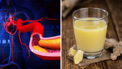 स्वयंपाक घरातील ‘या’ पदार्थाचे सेवन केल्यास कधीच होणार पित्ताचा त्रास, नसांमध्ये साचलेले खराब कोलेस्ट्रॉल होईल नष्ट