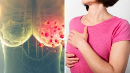 Breast Cancer: ब्रेस्ट कॅन्सर रुग्णांसाठी दिलासा! जसलोक हॉस्पिटलमध्ये ‘व्रणरहित’ शस्त्रक्रिया यशस्वी
