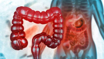 पोट व्यवस्थित स्वच्छ होत नाही? बद्धकोष्ठतेच्या समस्येपासून आराम मिळवण्यासाठी ‘हे’ घरगुती उपाय ठरतील प्रभावी, शरीर राहील स्वच्छ