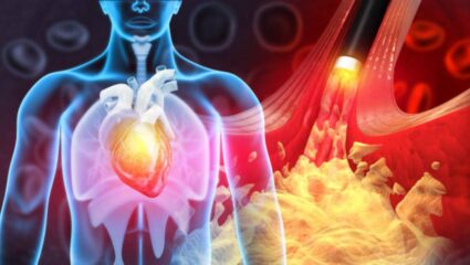 रक्तात वाढलेले कोलेस्ट्रॉल एका झटक्यात होईल कमी! रोजच्या आहारात नियमित करा ‘या’ फळांचे सेवन, हृदयाला होतील फायदे