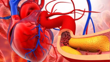 महिलांमध्ये दिसून येणाऱ्या ‘या’ लक्षणांमुळे कोणत्याही क्षणी करावी लागेल Angioplasty, वेळीच ओळख हार्ट अटॅकचा धोका