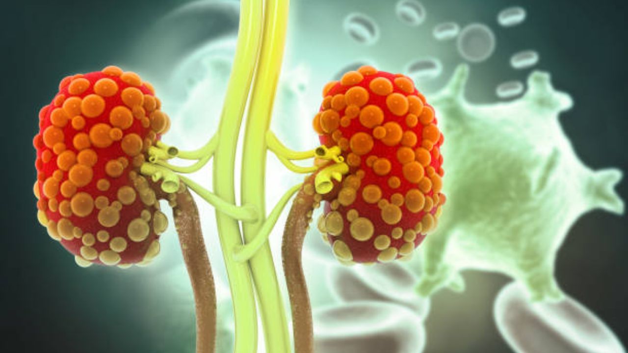 Kidney Damage Cause: जेवण बनवताना फॉलो केलेली ‘ही’ चूक शरीरासाठी ठरेल जीवघेणी, किडनी खराब होऊन येईल डायलिसिसची वेळ जेवण बनवताना फॉलो केलेली 'ही' चूक शरीरासाठी ठरेल जीवघेणी, किडनी खराब होऊन येईल डायलिसिसची वेळ