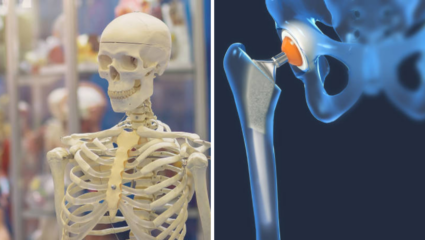 206 हाडांमधून रोज गळेल कॅल्शियम दिसाल सांगाडा, शरीरातील 1 गोष्ट बदलायच हवी; डॉक्टरांचे न ऐकून गमवाल जीव