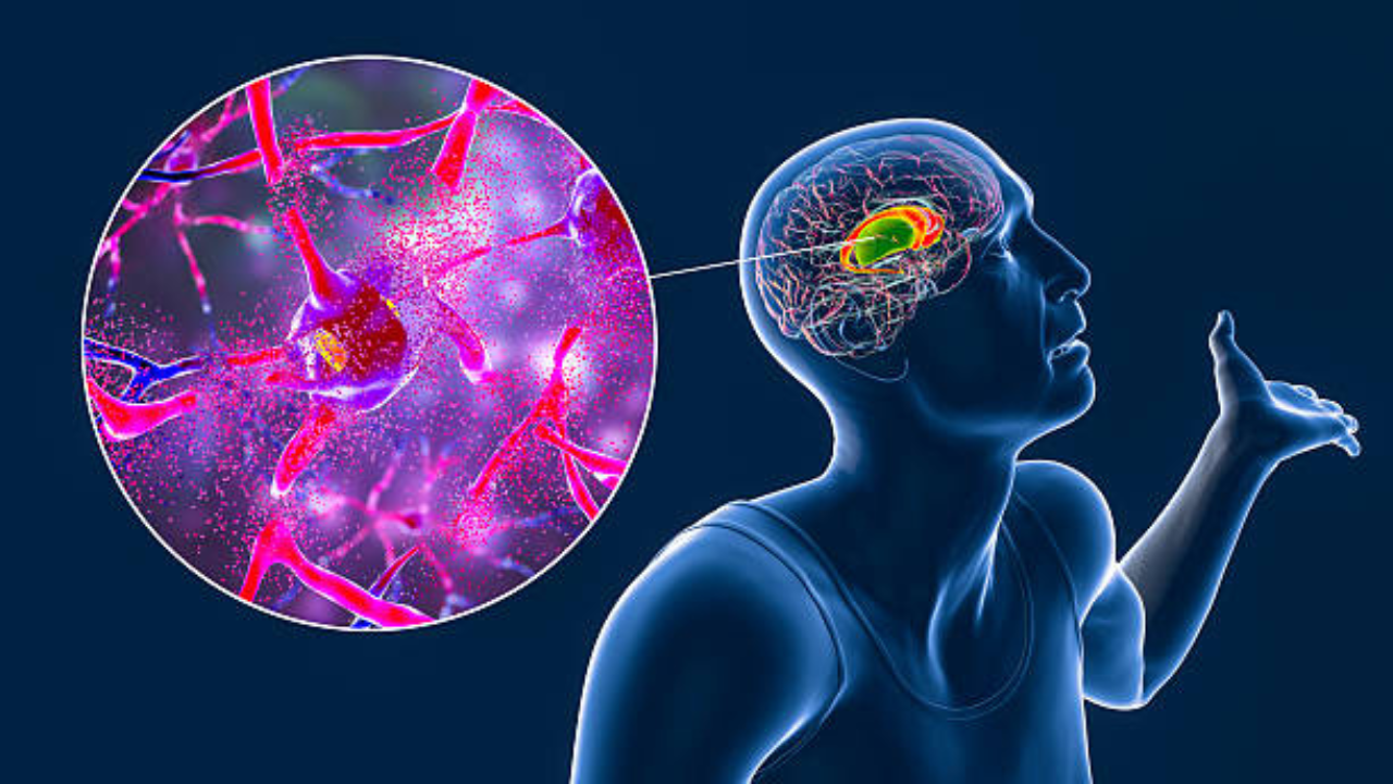 World Brain Stroke Day: ‘या’ 5 गोष्टी तुम्हाला ब्रेन स्ट्रोकपासून वाचवतील,  तज्ज्ञांकडून दिलासा ब्रेन स्ट्रोकबाबत माहिती (फोटो सौजन्य - iStock)