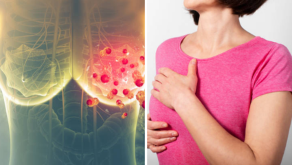 Breast Cancer: स्तन कर्करोगाच्या ‘या’ लक्षणांकडे दुर्लक्ष करू नका, खूप उशीर होण्यापूर्वी स्वतःला वाचवा