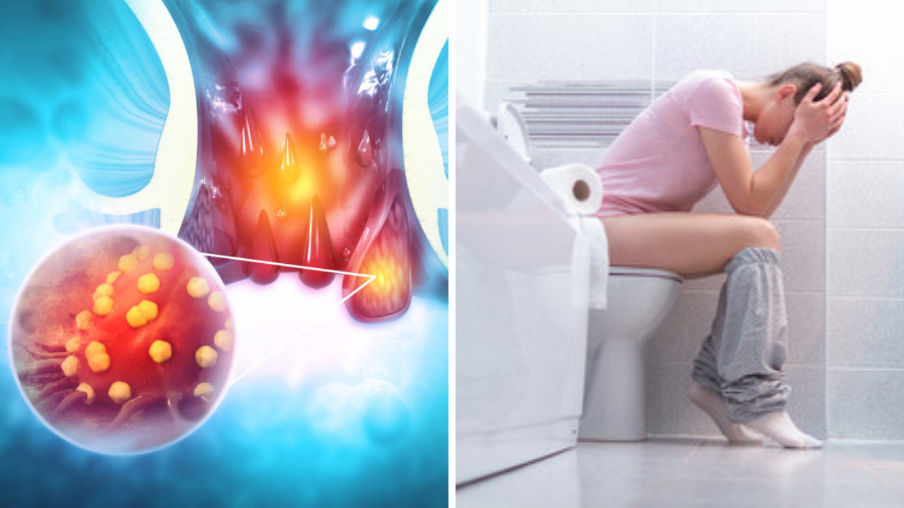Constipation Home Remedy: आता शौच होणार नाही कडक; लावावा लागणार नाही जोर; 10 रूपयात मिळाला देशी जुगाड बद्धकोष्ठतेवरील रामबाण उपाय (फोटो सौजन्य - iStock)