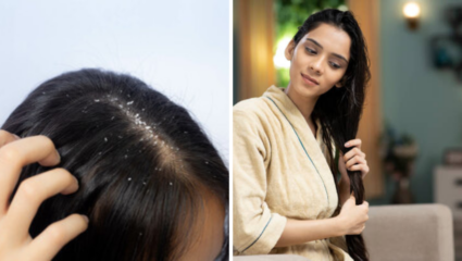 ‘या’ जादुई तेलाने होईल केसातील कोंडा त्वरीत फुर्र, गुडघ्यापेक्षाही लांब आणि घनदाट होतील केस