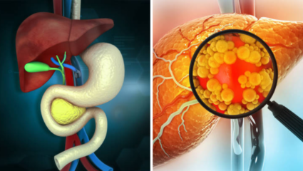हातात दिसले ‘हे’ 5 बदल तर व्हा सावध! Liver Damage चे संकेत करू नका दुर्लक्ष