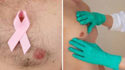 Breast Cancer: स्तन कर्करोग हा केवळ महिलांचा आजार? पुरुषांमध्येही वाढतोय स्तनाच्या कर्करोगाचा धोका