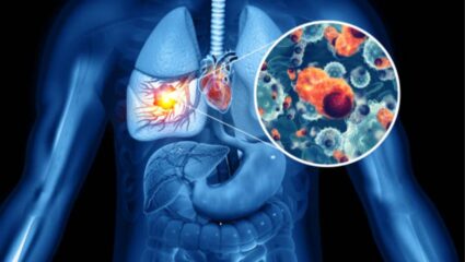 फुफ्फुसांमधील सर्व घाण-चिकट कफ लगेच बाहेर पडेल; फक्त डॉक्टरांनी सांगितलेल्या या 5 जालीम उपायांचा वापर करा