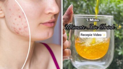 चेहऱ्यावरील सर्व डाग, मुरुम एका आठवड्यातच होतील गायब; फक्त 5 मिनिटांतच भारतीय मसाल्यांपासून घरी बनवा हे मॅजिकल ड्रिंक
