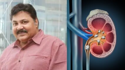 Satish Shah : झोपेची कमतरता आयुष्यासाठी ठरू शकते घातक? ज्येष्ठ अभिनेते सतीश शहा यांना होता गंभीर आजार, काय आहेत लक्षणं?