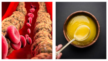 कोलेस्ट्रॉल सर्रकन वाढेल, हृदयचेही आरोग्यही बिघडेल; जास्त तूप खाण्याचे नुकसान, Alia Bhatt च्या न्यूट्रिशनचा सल्ला