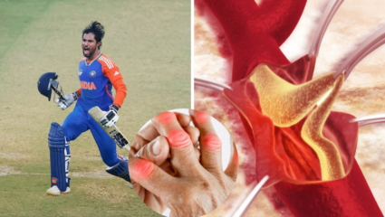 ‘तासातच मेलो असतो…’, मांस तुटून रक्तात मिसळत होतं, बोटं झाली कडक; Tilak Verma ला कोणता होता आजार?