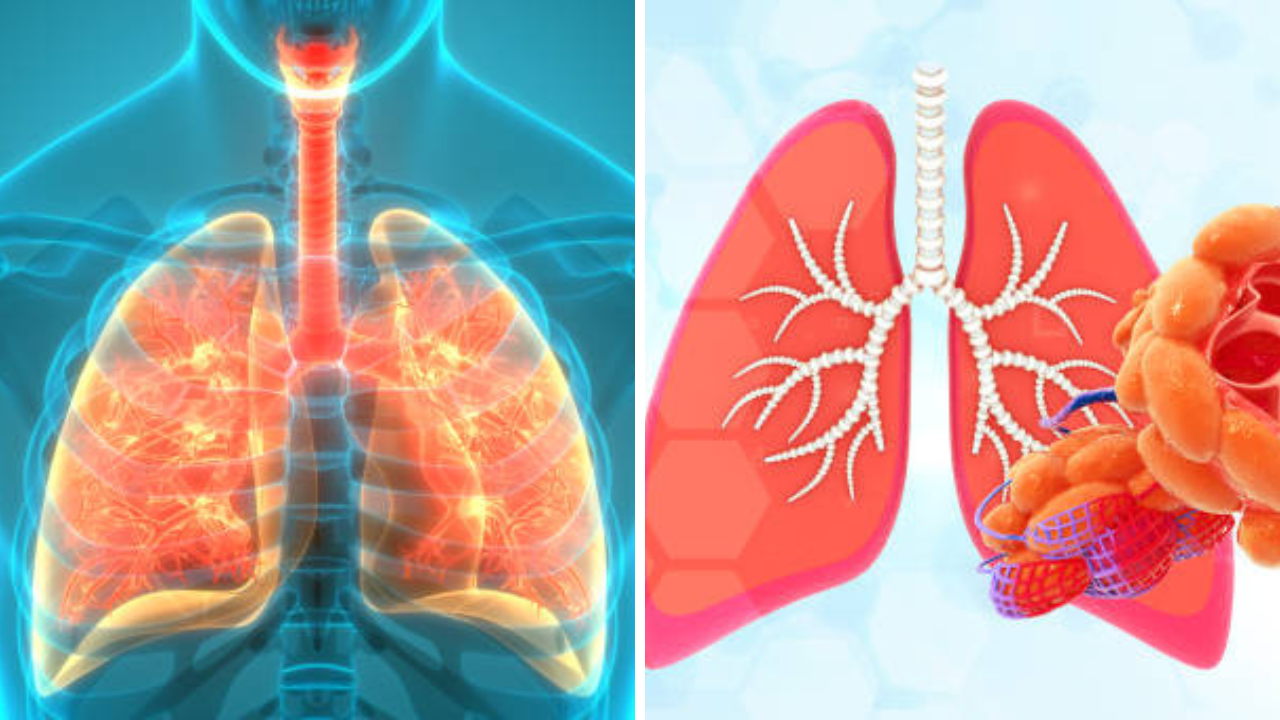 COPD च्या उपचारासाठी लवकर निदान होणे गरजेचे, काय आहे नक्की हा आजार; तज्ज्ञांनी दिला महत्त्वाचा सल्ला