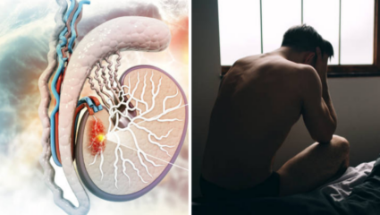 पुरूषांनो सावधान! Erectile Dysfunction ठरू शकते मधुमेहाचे लक्षण, वेळीच ओळखा धोका