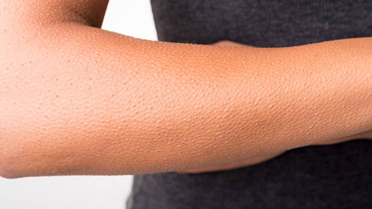 हे स्नायू सैल झाले की, आपल्या त्वचेवरील केस उभे राहतात, म्हणजेच अंगावर काटा येतो. वेगवेगळ्या व्यक्तींना वेगवेगळ्या प्रकारच्या भावना उत्पन्न होत असता. त्यावेळळी अंगावर Goosebumps म्हणजे काटा येतो. आपल्या शरीरावरचे केस उभे राहतात.