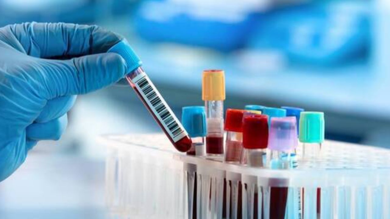 Pune News : रक्तचाचण्यांची गरज आणि उपयुक्तता: वाचा डॉक्टरांचा सल्ला