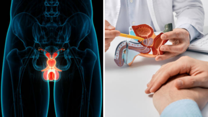 पुरुषांनो! तुमच्या आरोग्याबद्दल बोलणं लाजिरवाणं नाही, वाढत्या Prostate Cancer विषयी जाणून घ्या