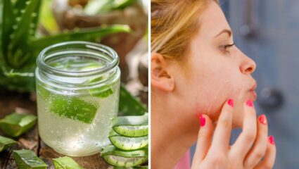 हिवाळ्यात भासणार नाही महागड्या स्किन केअर प्रॉडक्टची गरज, ‘या’ पद्धतीने चेहऱ्यावर लावा कोरफड जेल