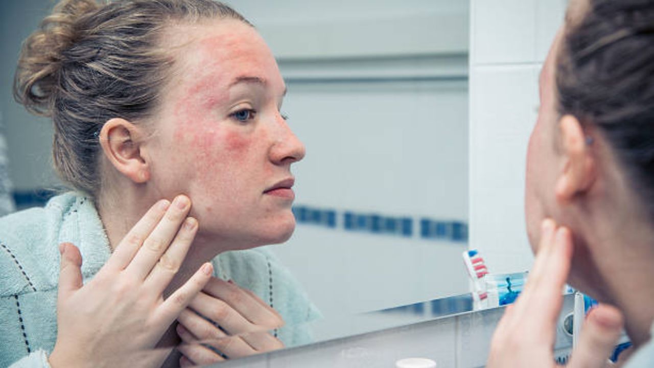 Skin Care Tips: हिवाळ्यात रात्री झोपण्याआधी चेहऱ्यावर लावा ‘ही’ क्रीम, सुरकुत्या- डार्क सर्कल्स गायब होऊन त्वचा होईल सुंदर