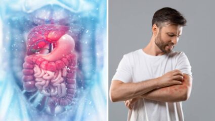 पित्त वाढल्यामुळे अंगावर लाल चट्टे येतात? मग आहारात करा ‘हे’ साधे बदल, पचनक्रिया राहील कायमच मजबूत- निरोगी