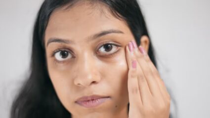 डोळ्यांखाली काळी वर्तुळ वाढली आहेत? शरीरात निर्माण झालेल्या ‘या’ विटामिनच्या कमतरतेमुळे त्वचा होईल निस्तेज