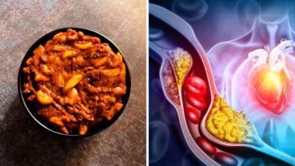 रक्तात वाढलेले खराब कोलेस्ट्रॉल नष्ट करण्यासाठी नियमित खा लसूण चटणी, ‘या’ पद्धतीने बनवल्यास शरीराला होतील दुप्पट फायदे