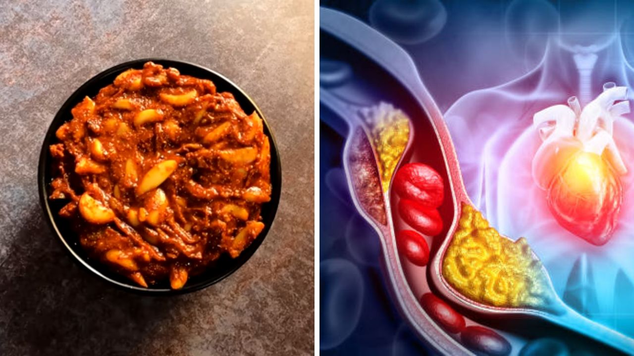 रक्तात वाढलेले खराब कोलेस्ट्रॉल नष्ट करण्यासाठी नियमित खा लसूण चटणी, ‘या’ पद्धतीने बनवल्यास शरीराला होतील दुप्पट फायदे