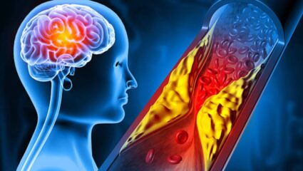 खराब कोलेस्ट्रॉलमुळे हृदयाच्या रक्तपुरवठा बंद झाला आहे? रक्तवाहिन्या स्वच्छ करण्यासाठी नियमित करा ‘या’ पदार्थांचे सेवन