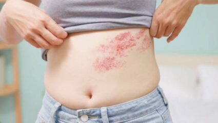 शरीराच्या कोणत्याही अवयवांवर आलेल्या पाणीदार फोड्यांकडे चुकूनही करू नका दुर्लक्ष! आरोग्यासंबंधित उद्भवेल गंभीर आजारांचा धोका