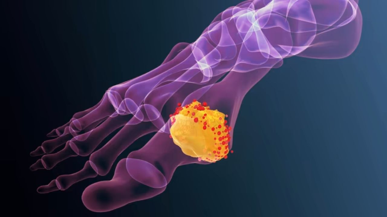 सांध्यांमध्ये वाढलेले Uric Acid महिनाभरात लघवीवाटे पडून जाईल बाहेर! रोजच्या आहारात करा ‘या’ भाज्यांचे नियमित सेवन