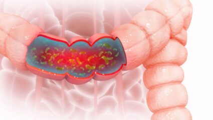आतड्यांमध्ये साचून राहिलेला विषारी कचरा क्षणार्धात पडून जाईल बाहेर! गरम पाण्यात मिक्स करून प्या ‘हा’ जादुई पदार्थ, पोट होईल स्वच्छ